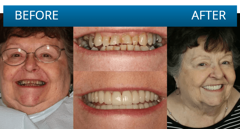 Before and after dental treatment result
