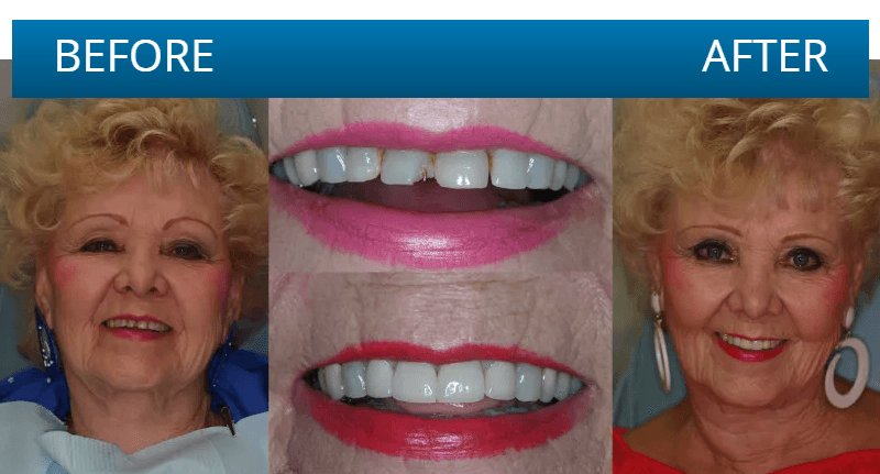 Before and after dental treatment result